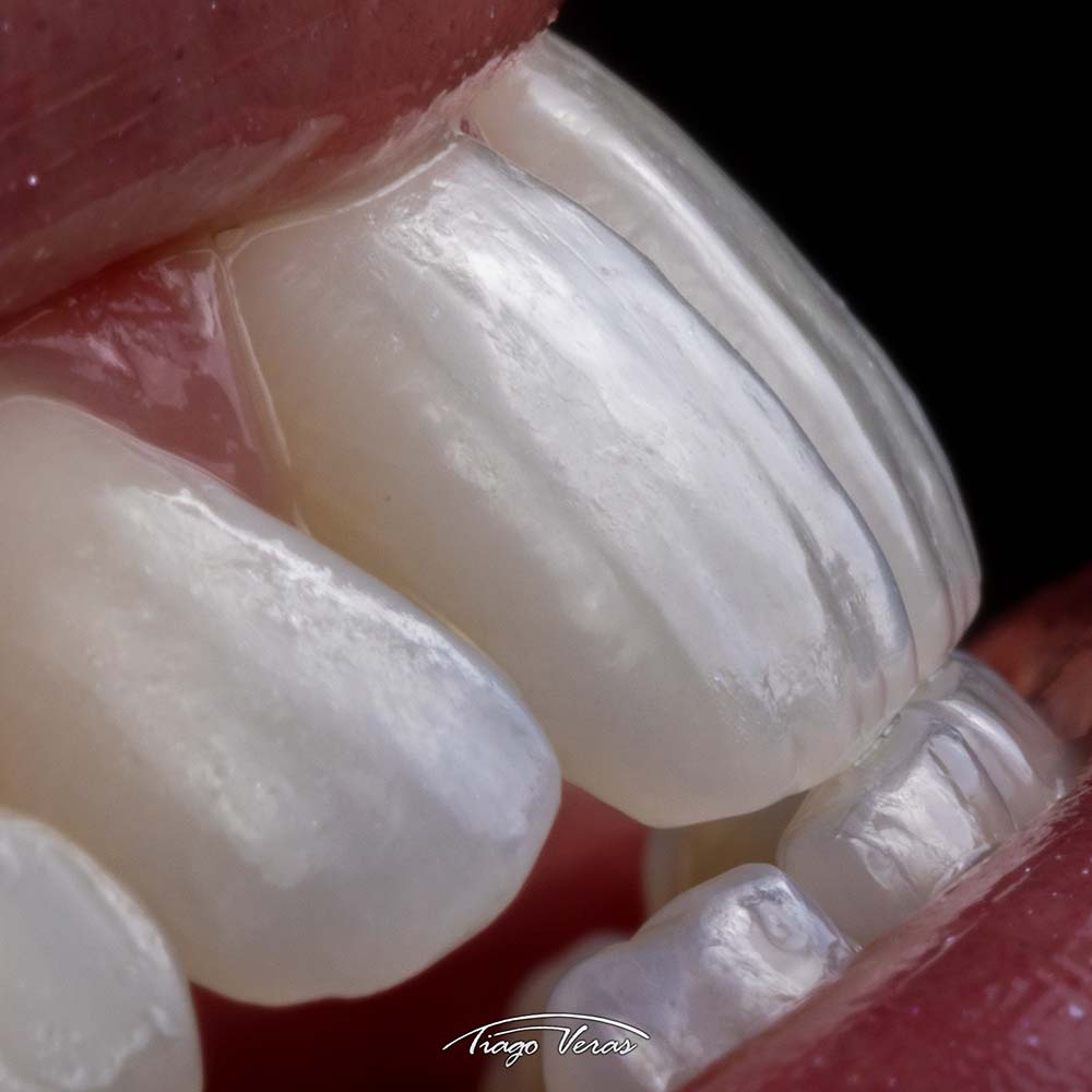 textura dental